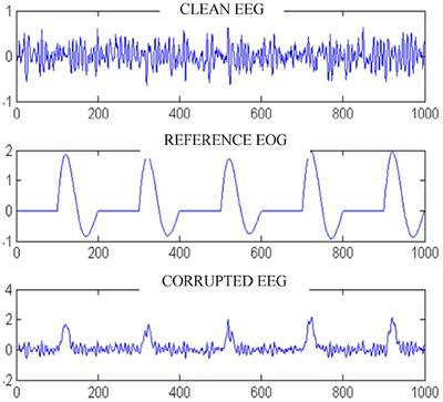 Formulation of the Challenges in Brain-Computer Interfaces as Optimization Problems—A Review